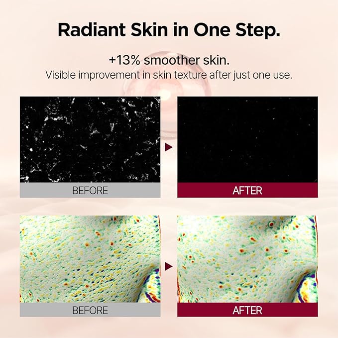 PONGDANG Nourishing Rice-Paste Wash-Off Mask | Gentle Exfoliation & Oil Control | Hydrating Care with Organic Rice Extract & Antioxidants | Helps Improve Skin Tone & Texture | Korean Skin Care