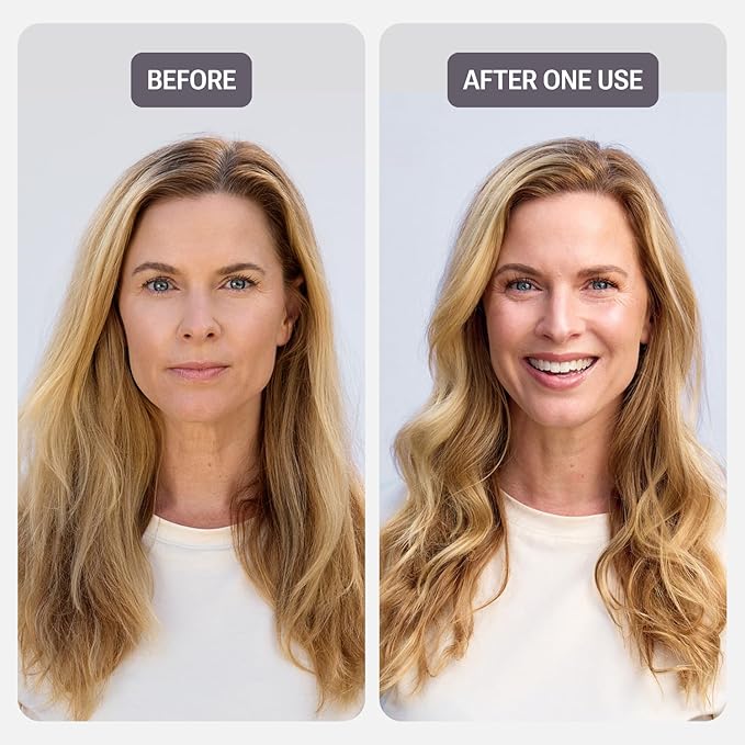 NULASTIN Vibrant Scalp Conditioner - Volumizing Hair Conditioner for Women & Men - Reduce Frizz & Breakage - Enhance Shine - Clinically Tested & Color-Safe - Silicone-Free & Vegan (10 Fl Oz)