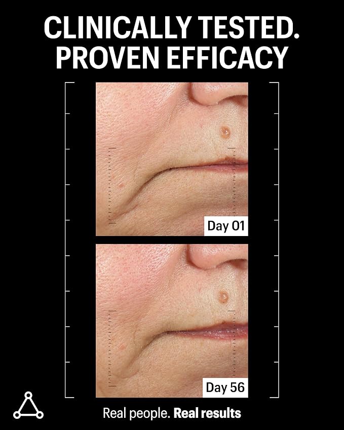 Allies of Skin Peptides & Antioxidants Advanced Firming Daily Treatment with 13 Brighteners, 9 Antioxidants, 7 Firming Peptides, 5% Teprenone & Ferulic Complex and 3% Biotech Algae Complex 20ml/0.67oz