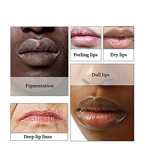 2pcs Lip Lightening for Dark Lips Lip Brightener for Smokers Dark Lip Treatment Lightening Cream for Pink Lips Lip Lightener for Smoker Lips Lip Lightening balm for Men and Women (Pink)