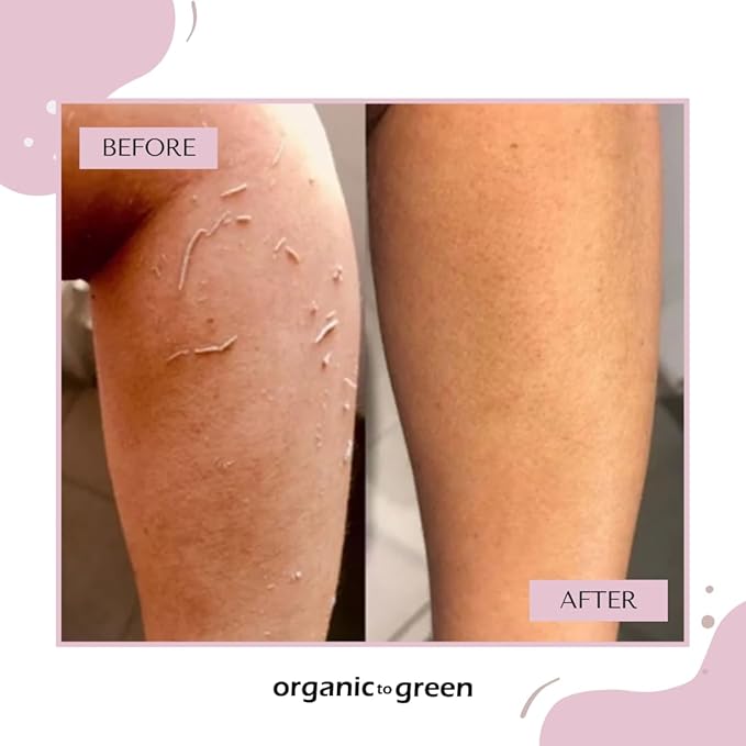 Organic to Green Premium Exfoliating Mitt for Body (2pc) – 100% Vegan Viscose Traditional Body Scrub Washcloth – Body Exfoliator (Pink)