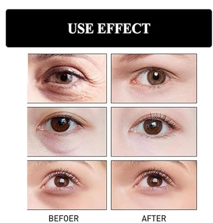 Berbax Instant Firm Eye Tightener, Berbax Eye Bag Cream, Berbax Dark Circle Eye Cream, Berbax Brightening Firming Eye Cream, Berbax Instant Firming Anti-Aging Eye Cream (1.05OZ)