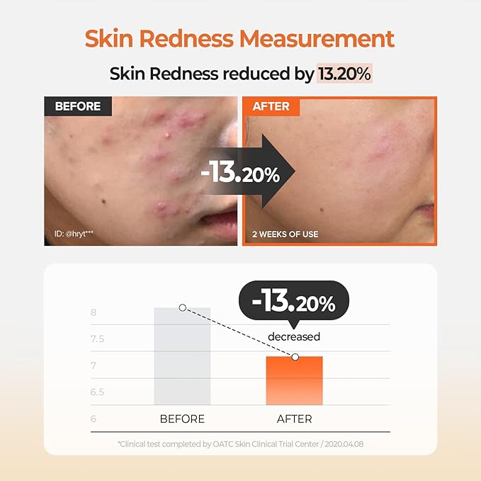 SKINFOOD Carrot Carotene Calming Water Toner Pads, Korean Skin Care Toner Pad for Face, Deep Hydrating, Soothing, After Sun Skincare for Sensitive Skin, Redness Relief, 100% Cotton, 8.81 oz (60 Pads)