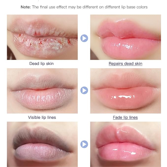 Lip Repair Gel, Moisturizing Lip Repair Soft Moisturizing Lip Care, Soothe & Protect Lip Balm.