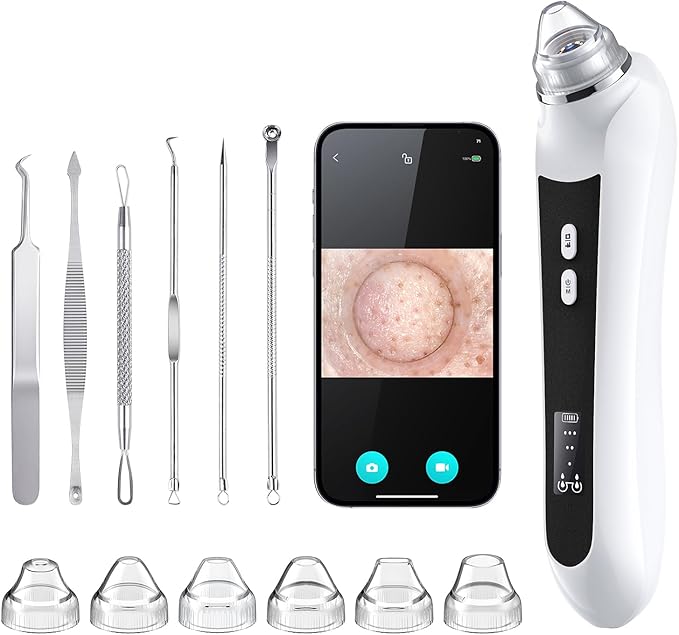 Facial Pore Blackhead Remover Vacuum, 1080P Camera Blackhead Remover, 20x Zoom, 8 LEDs ＆ 3 Suction Modes, 800mAh Battery & USB - 6 Heads Pore Cleaner Kit for Women&Men(Black)