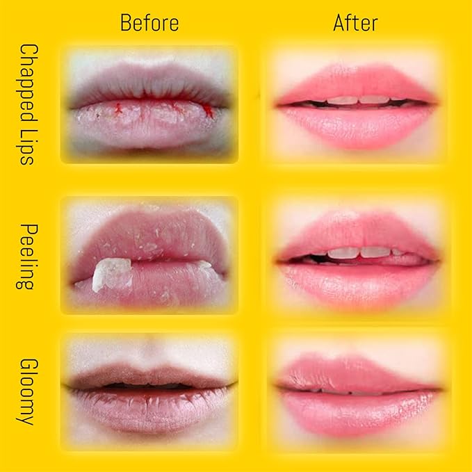 4PCS Lip Balm Honey Pot, Honey Pot Lip Balm for Dry Cracked Lips, Strawberry Lip Balm Scrubs Exfoliator & Moisturizer, Hydrating Lip Balm Honey Pot with Wand, Lip Sleeping Mask (D)