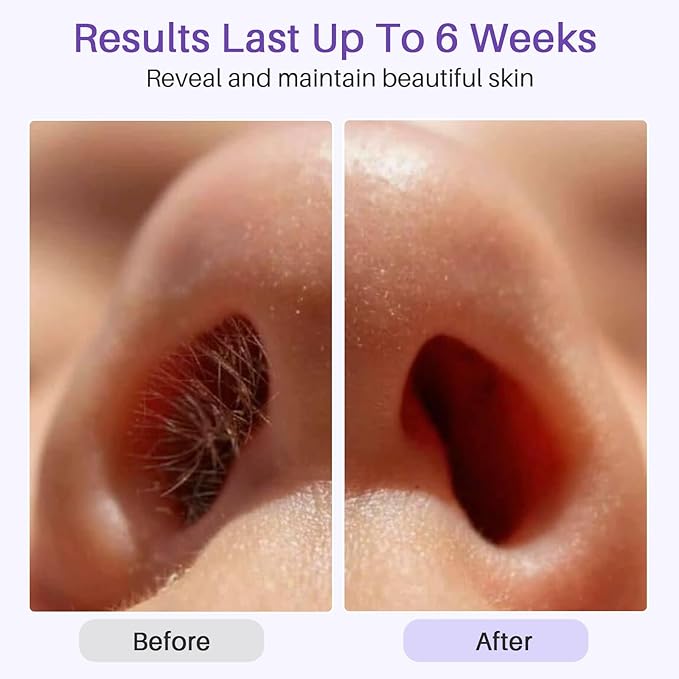 BLITZWAX Single Waxing Pot, Hard Wax Warmer for Face, Legs, Bikini, Brazilian and Body, for 16 oz, At Home Hair Removal Kit, for Men, Beginner Friendly, Quick Heating, Precise Temperature Control