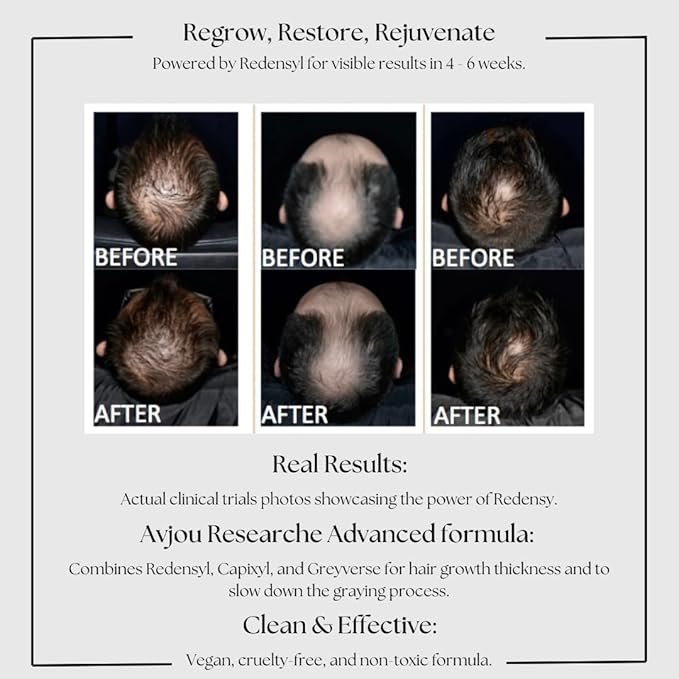 Avjou Researche™ Scalp Serum – Thicker, Fuller-Looking Hair + Targets Visible Signs of Premature Greying – 3 Patented Ingredients – Backed by Cosmetic Science – Oil-Free, All Hair Types, 1.7 oz