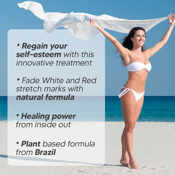Cicatrissim Deep Stretch Mark Removal Cream - Innovative Formula With Pure and Powerful Natural Ingredients From Brazilian Flora - For All Stretch Marks & Skin Types.