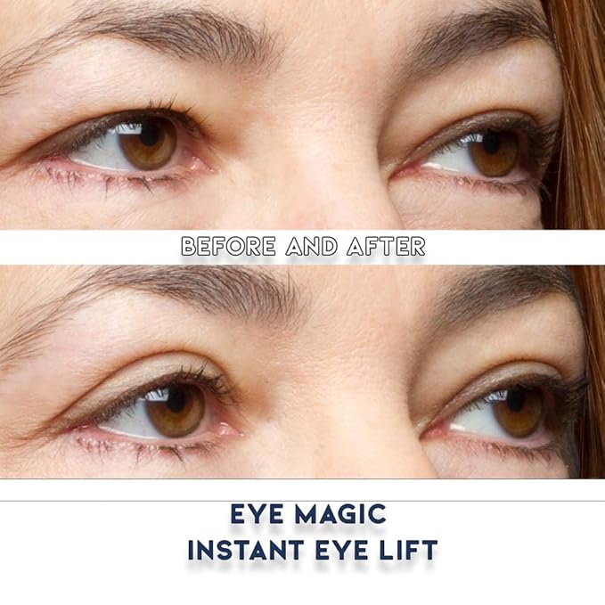 Eye Magic Premium Eye Lift (L/XL Refill) Made in America Lifts and Defines Droopy, Sagging or Hooded Eyes Safe For Daily Use