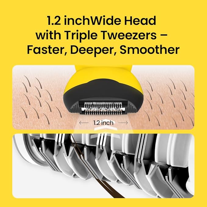 Gorilla Technique Epilator 3000V, Facial & Body Hair Removal Device, Pain Relief Roller, Cordless Rechargeable Electric Tweezers for Women & Men, Triple Tweezers, 8000RPM, Korean Skin Care - 3000V