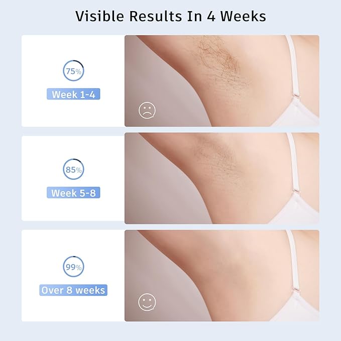 Laser Hair Removal,Laser Hair Removal for Women, 999999 Flashes,Hair Removal Device,ipl laser hair removal for Facial Legs Arms Whole Body Use (White-Rose Gold)