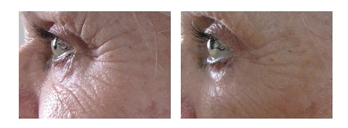 Airelle Age-Defying Eye and Lip Treatment | Anti Aging, Helps Reduce Wrinkles, Fine Lines | Dermatologist Recommended | Hyaluronic Acid, Berrimatrix | Natural Ingredients | .3 Fl Oz