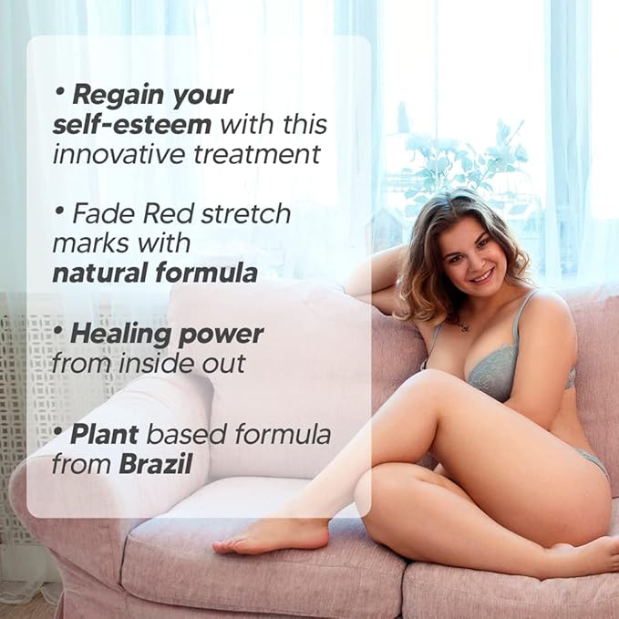 Cicatrissim Red For Removal of Red and Purple Stretch Marks - Innovative Formula With Pure and Powerful Natural Ingredients From Brazilian Flora - For All Skin Types.