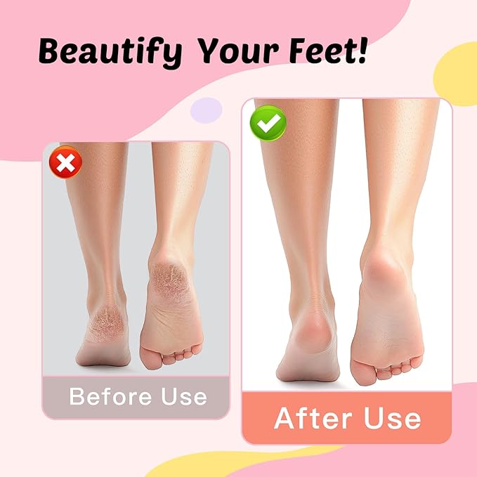 Electric Foot Callus Remover & Nail File - Electric Callus Remover for Feet, 9 Adjustable Speeds, 1800mAh Rechargeable, Portable Aluminum Body w/Type-C Charging for Home & Travel (Black)