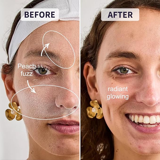 Face Razors for Women, Dermaplane Razor for Women Face, Eyebrow Razor, Dermaplaning Tool, Skin Safe Microblades, Peach Fuzz Remover (9ct, Solar Veil)