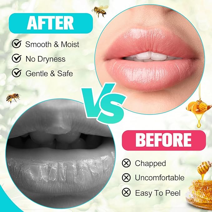 24 Pcs Nurse Appreciation Gifts Bulk Lip Balm Bulk for Women Nurses Thank You Gifts Honey Flavor Lip Balm Nursing Doctor Gifts for Nurse Week Graduation