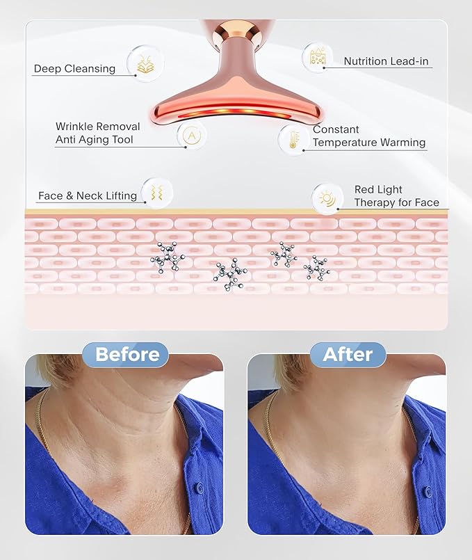 Light Based Face-Neck-Massager - 7 Color Portable Facial Massager for Skin Care, Rose Gold