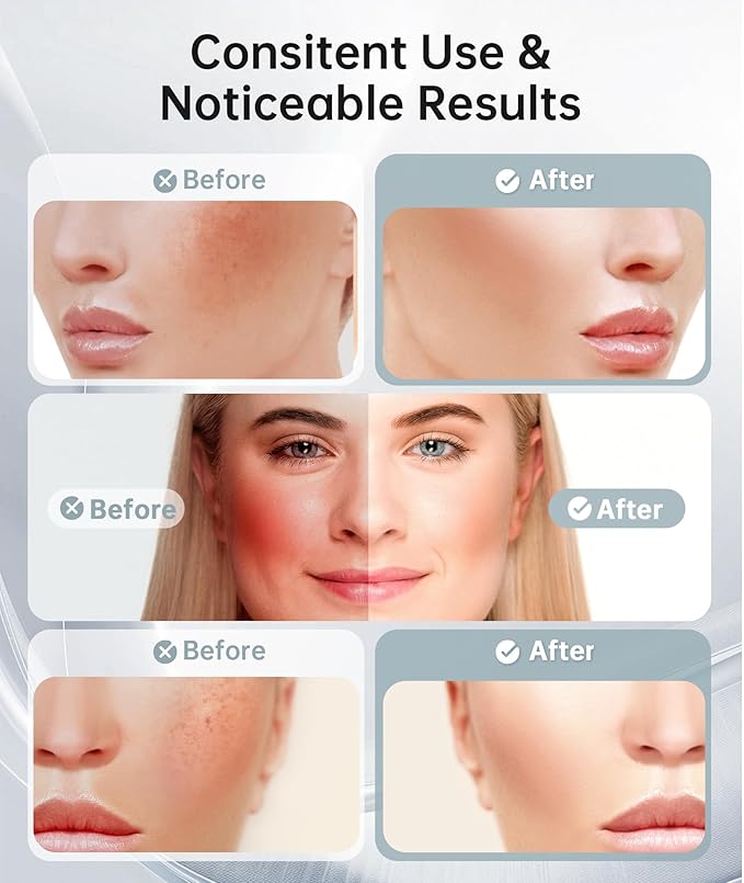 7 Color Light Therapy Facial Massager with Adjustable Vibration and Thermals for Wrinkles, Double Chin, Red Light Skin Care Tool with Base, Black