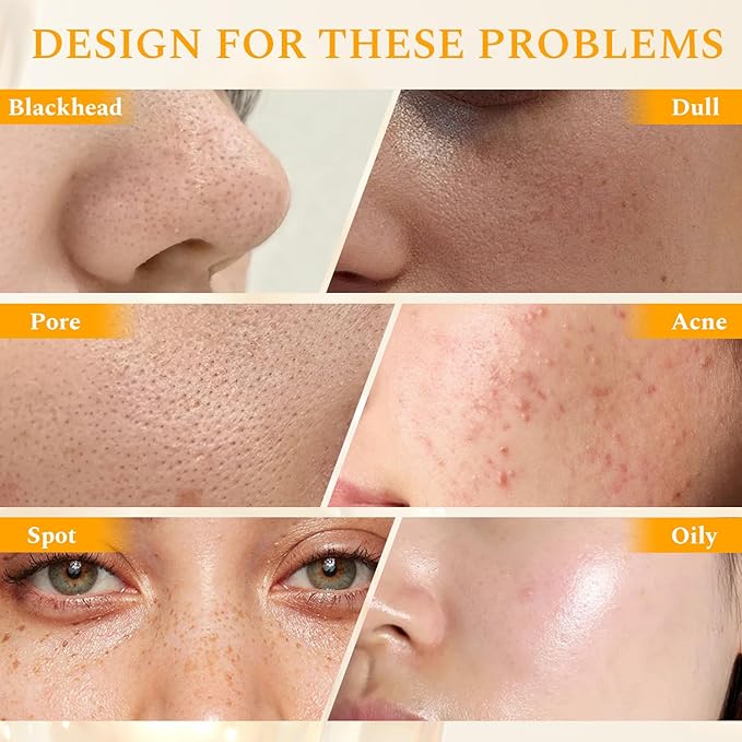 Vitamin C Face Scrub Face Exfoliator Cream Brightening Facial Scrub Exfoliating Facial Wash Microdermabrasion Facial Scrub, Gently Exfoliate Dirt and Dead Skin Cells, Improve Dark Spot, 140g/5oz