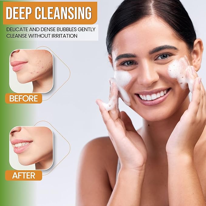 Turmeric Face Wash - Turmeric Facial-Cleanser with Aloe Vera, Vitamin E, and Natural Extracts - Lightweight Daily Gel Face Wash for All Skin Types - 120ml