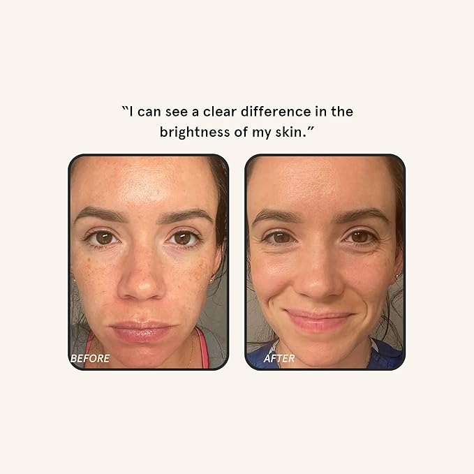 Barefaced Liquid Gold 1 Fl Oz - 15% Vitamin C Serum with Hyaluronic Acid & Vitamin E for Anti-Aging, and Hydration, Antioxidant Formula, Reduces Dark Spots, Acne & Wrinkles