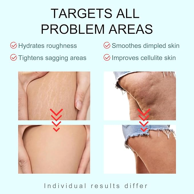 B-TIGHT Body Cream, 200ml Leave-On Booty Enhancing Mask, Firming & Moisturizing Cream, Leave-On Cellulite Mask - Improves Skin Tightness in Buttock Area, Lift sagging skin - 6.76 oz