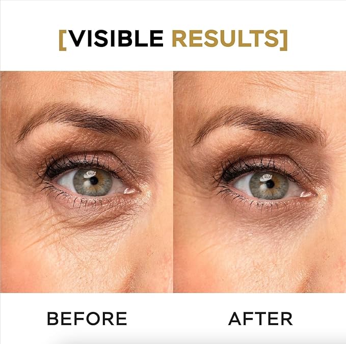 Moisturizing Eye Cream w/Aloe Vera, Collagen, Hyaluronic Acid, Cotton Stem Cells for Dark Circles, Puffiness & Bags - Under Eye Hydration Cream for Women & Men (1 Fl Oz)