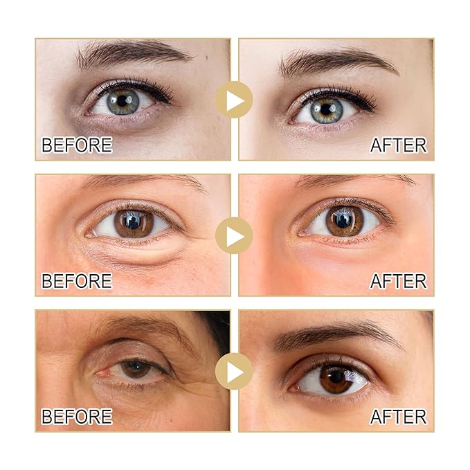 Eye Cream, Collagen Under Eye Cream with Hyaluronic Acid for Dark Circles, Puffy Eyes & Wrinkles, Anti Aging Eye Cream, 1 Fl. Oz