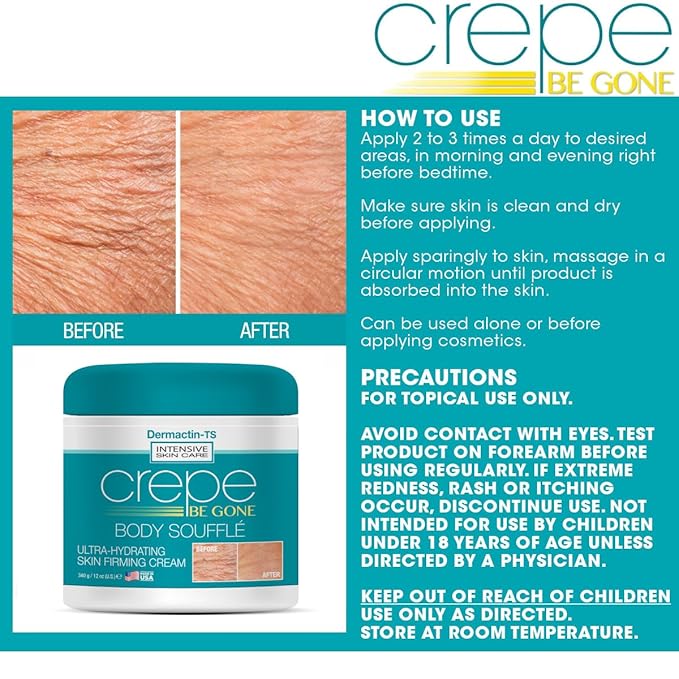 Crepe Be Gone Body Souffle Classic - Large 12 ounce - Ultra Hydrating Crepe Skin Firming Cream for Neck,Chest, Arms & Legs