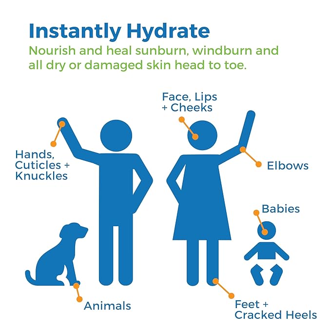 Waxhead Aftersun Body Butter for Sunburn Relief - Also great Tattoo Balm, Eczema Cream for Kids Adults, After Sun Lotion, Sunburn Treatment, Healing Salve