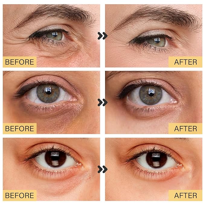 25 Paris Under Eye Patches Eye Mask for Puffy Eyes, Reducing Dark Circles, Anti-Aging & Refreshing, Collagen Eye Mask Eye Pads for Skin Care, 24K Gold