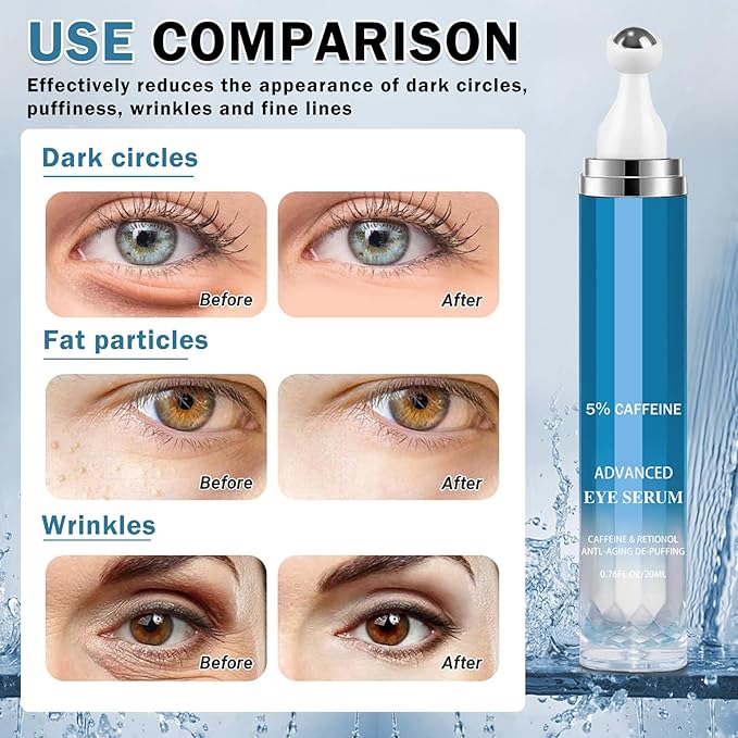 Caffeine Under Eye Cream for Dark Circles Eye Cream for Puffiness and Bags Under Eyes,Eye Roller for Puffy Eyes and Firming,Wrinkle Reducing Crema Para las Ojeras