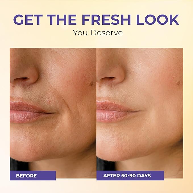 Daily Defense Mineral Sunscreen Face Moisturizer With SPF 30 + Hyaluronic Acid, Collagen, Peptides | Sun Screen Face Lotion, Sunblock Face Sunscreen | Reef Safe Sunscreen