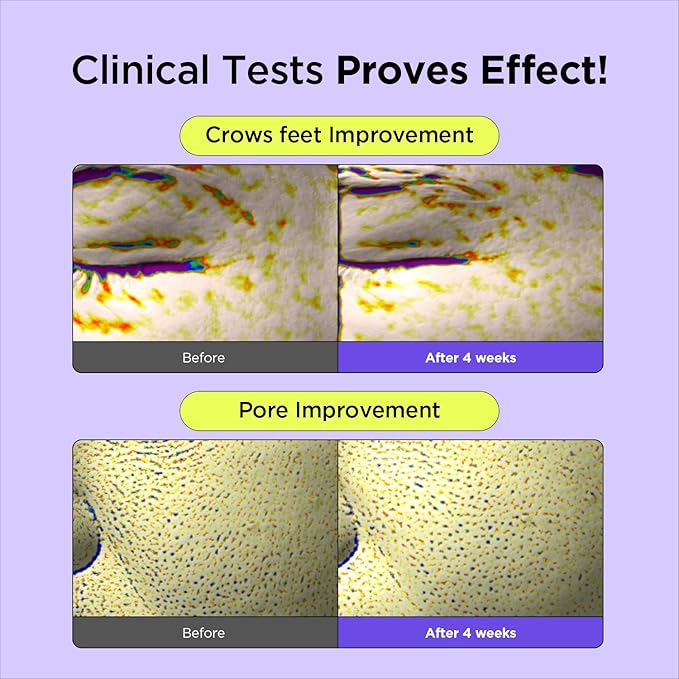 BY WISHTREND Vitamin A-mazing Bakuchiol Night Cream | Retinal, Peptide, Collagen, Ceramide NP, Centella Asiatica, moistfully plump overnight skincare (1.05 Ounce (Pack of 1))