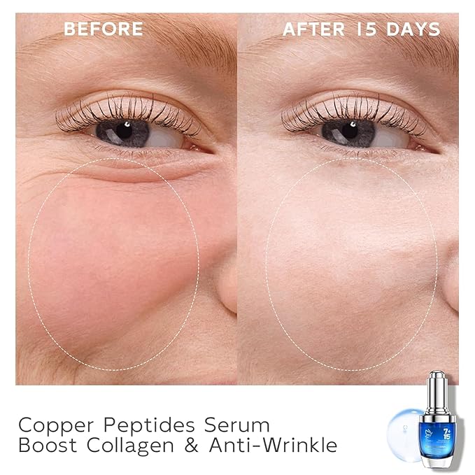 Copper Peptides Serum for Face - Peptides Collagen Renewal & Anti-Aging Serum - GHK-Cu, EGF, Hyaluronic Acid,Collagen - Anti Wrinkle, Firming, Moisturizing-Korean Skin Care,25mL/0.88 Fl Oz