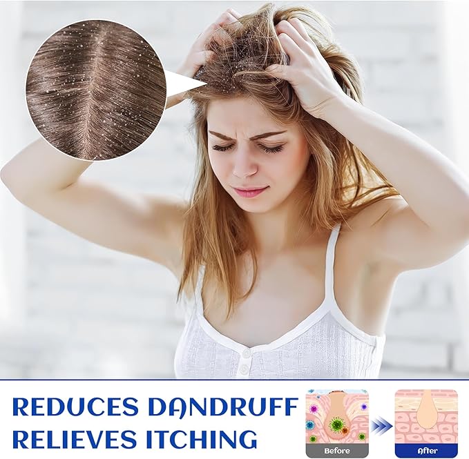 HIQILI Rosemary Oil for Hair Growth, Add to Shampoo & Conditioner, 100% Pure Undiluted - 16 Fl Oz