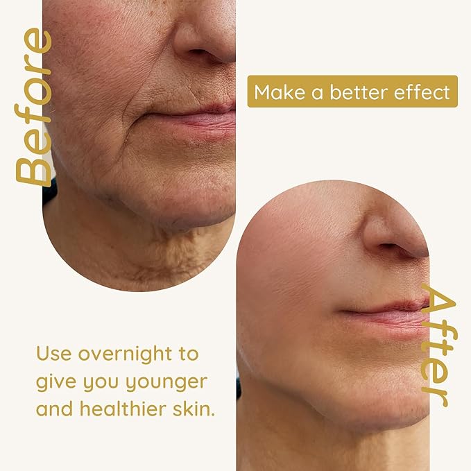 Enaskin Naturals 5 in 1 Anti Wrinkle Face Patches Anti Wrinkle Gel Face Masks (5 in 1 Pack)