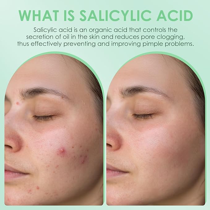 AUSLKA Salicylic Acid Oil Balancing Spray with 2% Salicylic Acid Regulates Skin Balance for Pimple and Oily Skin, Fruit Acid Spray for Face & Body (3.4 Fl Oz)