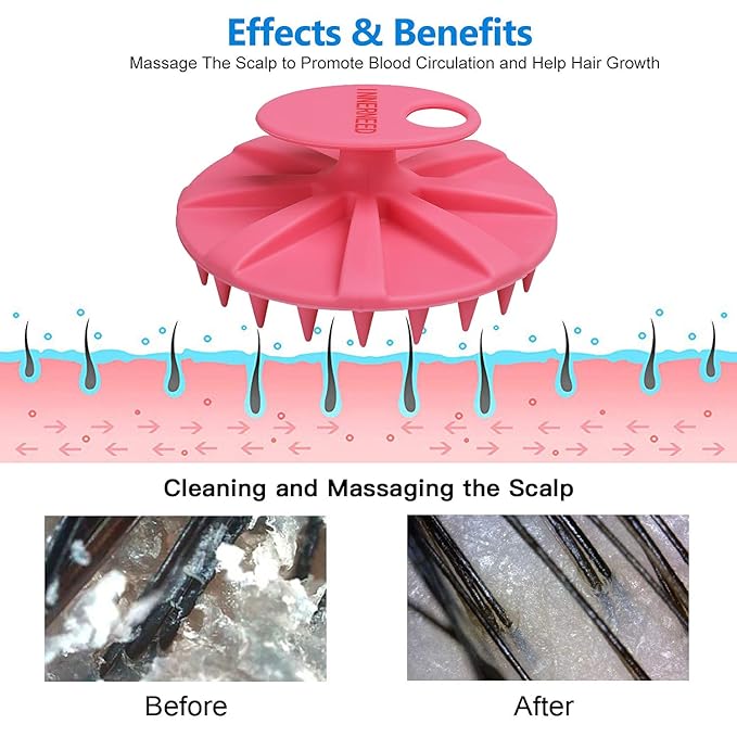 INNERNEED Scalp Massager Shampoo Brush, Wet & Dry Manual Scalp Care Head Scrubber Hair Washing, Soft Silicone Bristles, for Hair Growth, Dandruff Removal, Comfortable for All Hair Types (Pink)