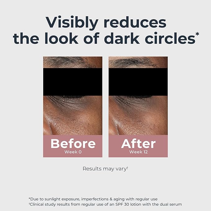 Eucerin Radiant Tone Eye Cream Dark Circle Corrector, Eye Brightening Cream with Thiamidol and Hyaluronic Acid, Helps Reduce the Look of Eye Puffiness, 0.5 Oz Tube