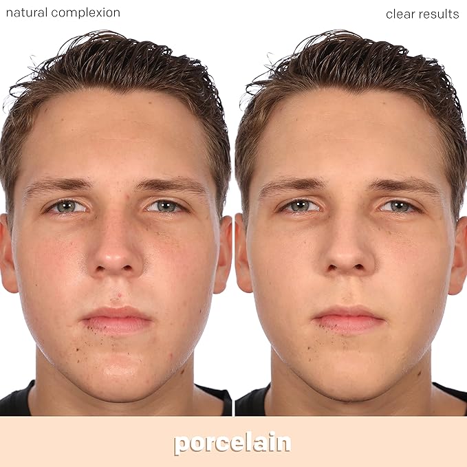 Almay Clear Complexion Acne Foundation Makeup with Salicylic Acid - Lightweight, Medium Coverage, Hypoallergenic, Fragrance-Free, for Sensitive Skin, 099 Porcelain, 1 fl oz.