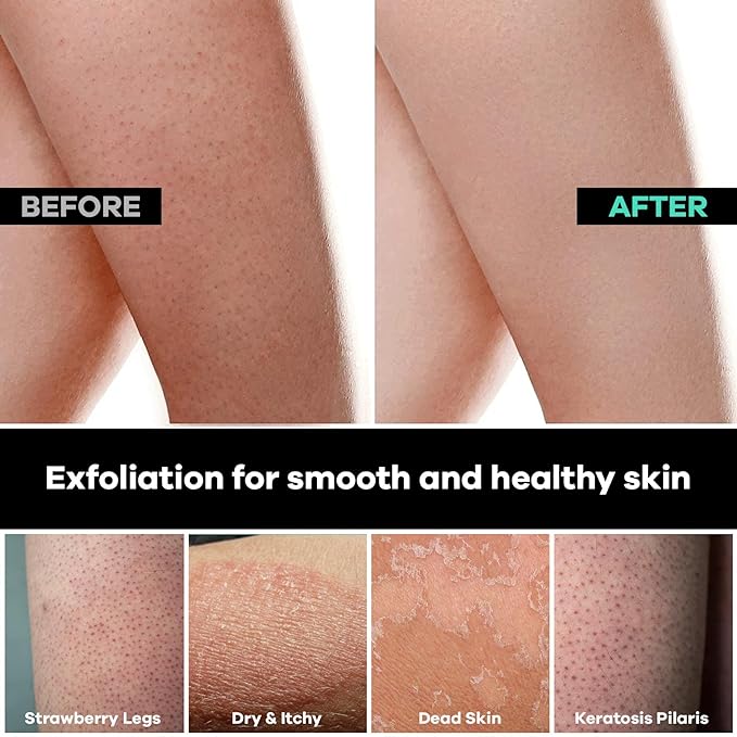 Dermasuri Deep Exfoliating Glove for Shower - Scrubbing Mitt Body Scrubber Gloves Skin Exfoliator & Eliminates Dead Skin - Keratosis Pilaris Scrub Spray Tan Remover - Korean Skincare for Body (2 Pack)