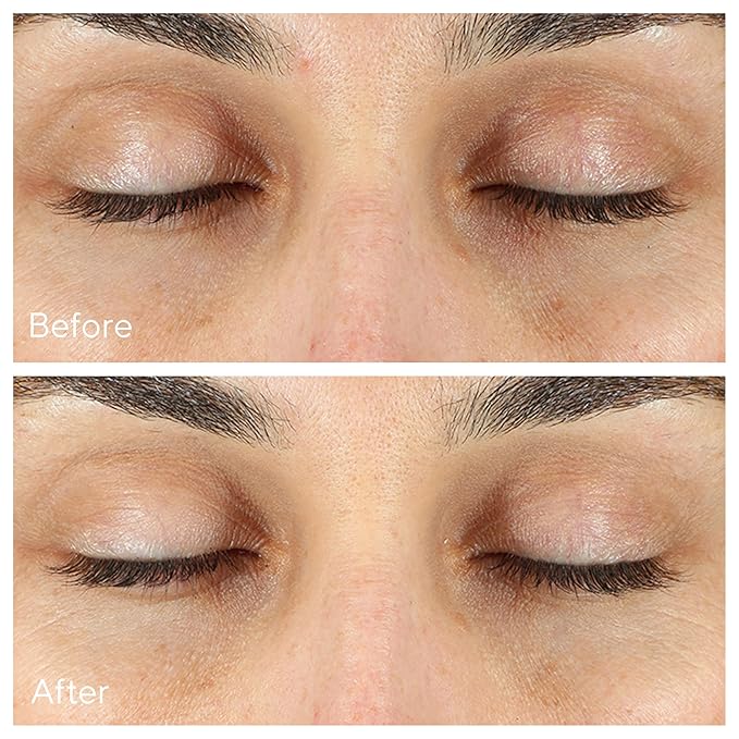 Murad Vita-C Eyes Dark Circle Corrector – Environmental Shield Vitamin C Brightening Serum – Anti-Aging Treatment for Puffiness and Wrinkles, 0.5 Fl Oz