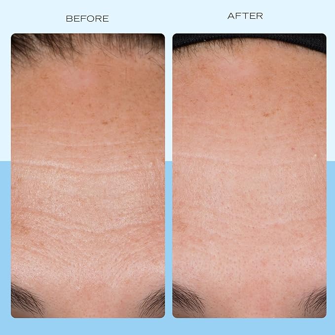 First Aid Beauty Firming Collagen Cream with Collagen, Peptides and Niacinamide – Day + Night Anti-Aging Face Moisturizer – 1.7 fl oz