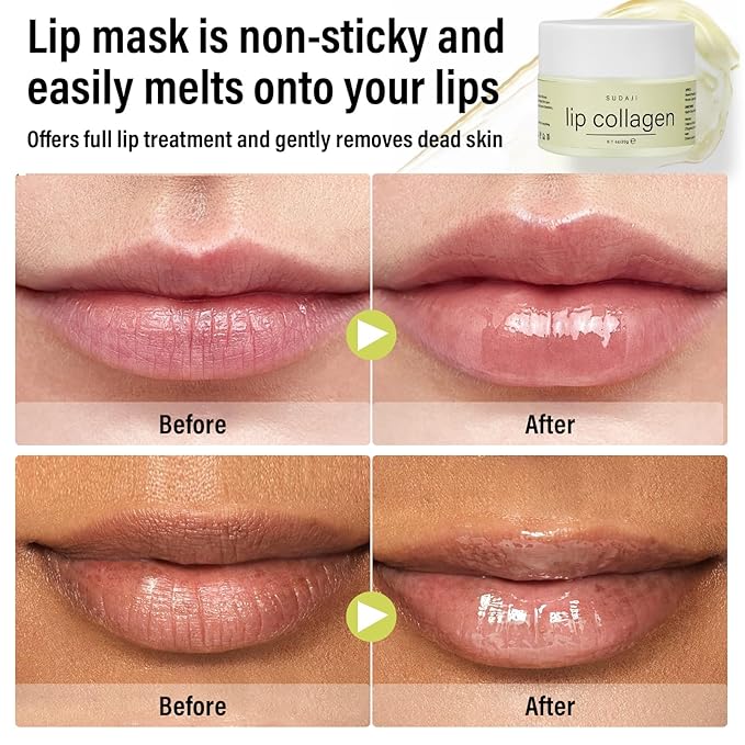 Lip Collagen + Peptide Complex, Collagen Lip Balm with Vitamins E, A -Lip Butter to Nourish & Hydrate Dry Cracked Lips, Moisturizing Lip Mask Overnight, Gentle exfoliating Lip Butter Balm