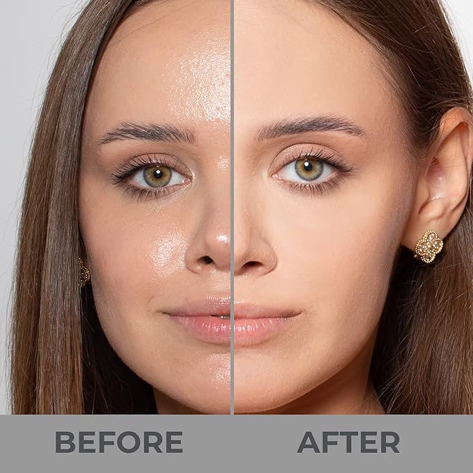 LAMEL Smartskin Serum Tinted Foundation - Hydrating & Nourishing - Hypoallergenic & Skin-Caring - Color Correcting - Anti-Aging Formula with Hyaluronic Acid - 402, 1,18 fl.oz