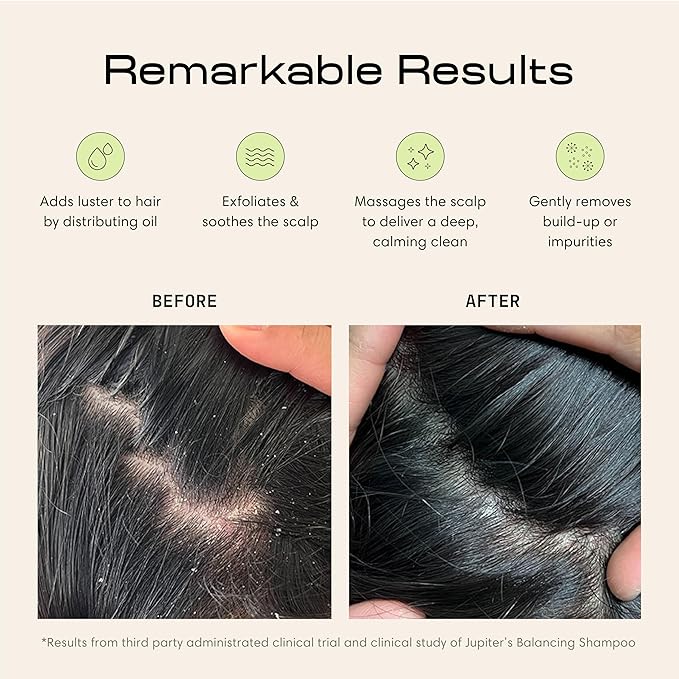 Jupiter Exfoliator Brush for Removing Dandruff and Build-Up, Detangling Scrubber for Wet or Dry Hair, Supports Circulation and Growth, Suitable for All Hair Types, Black