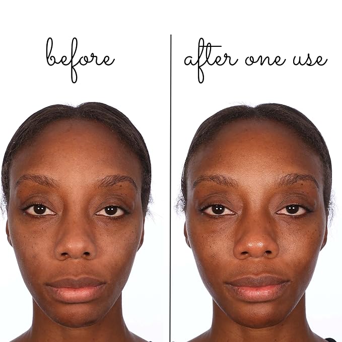 Consult Beaute Volumagen Miracle Plumping Barrier Balm - Facial Moisture Slugging - Overnight Deep Skin Hydration - Dry Skin - Hyaluronic Acid - Petrolatum Free - Lanolin Free - Mineral Oil Free 1 oz