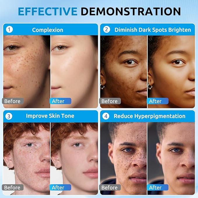 HANYWIL Dark Spot Corrector Cream for Hyperpigmentation,Brightening Serum for Face & Body,Rapid Fade Treatment for Sun Spots, Age Spots & Melasma,Dermatologist-Tested Skin Tone Evenser (2.0 Fl Oz)